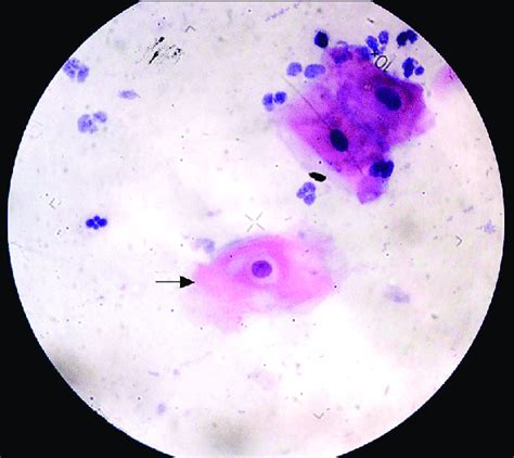 Micrograph Shows Human Buccal Cells Stained By The Method Of Pap