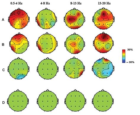 Behavioral And Neurophysiological Effects Of Repetitive Transcranial