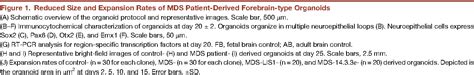 Figure 1 From An Organoid Based Model Of Cortical Development