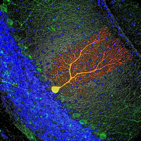 Purkinje Nerve Cell 1 By Science Photo Library