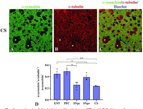 α Synuclein And α Tubulin Colocalization In Different Brain Areas Of Wt Download Scientific