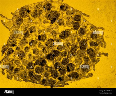 False Colour Transmission Electron Micrograph Tem Of A Human Mast