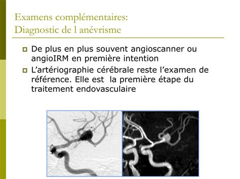 Ppt Hypertension Intracrânienne Traumatismes Craniens Tumeurs