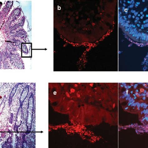 Ileal Mucosa Of Patient After Different Staining A C Noninflamed