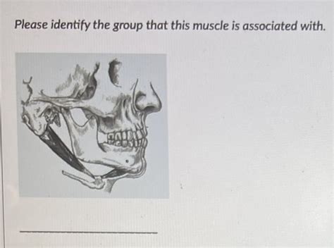 MSK Exam 2 FINAL Flashcards Quizlet