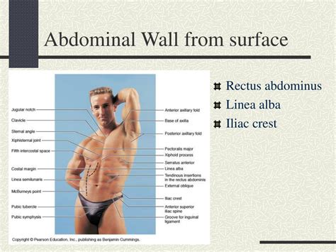 Ppt Abdominal Wall And Cavity Powerpoint Presentation Free Download