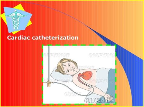 Angioplasty Vs Bypass