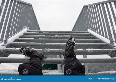 Legs Of A Man With A Broken Leg On A Blue Background X Ray Image Of