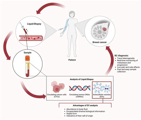 Liquid Biopsy For Breast Cancer Bc Diagnosis Body Fluids Are