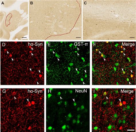 Oligodendroglial Selectivity Of Mbp Driven A Syn Expression In Macaque