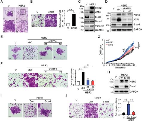 Figure 1 From HER2 Upregulates ATF4 To Promote Cell Migration Via