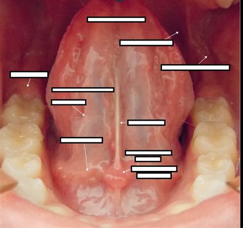 Anatomic Landmarks Of Oral Cavity Ventral Tongue View Diagram Quizlet