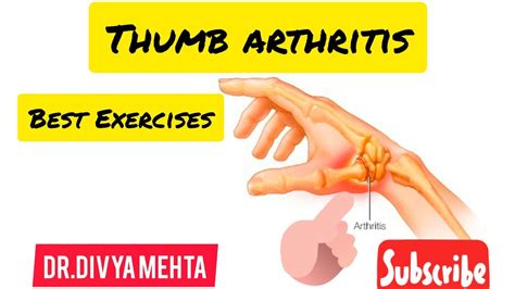 अगठ म गठय Thumb Arthritis हन क लकषण करण और इलज Best