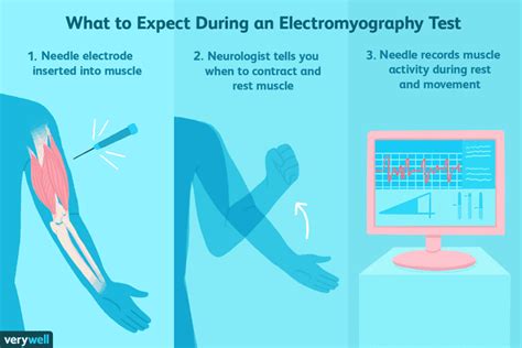 Électromyographie Utilisations effets secondaires procédure résultats