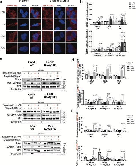 Sqstm P Nuclear Localization Regulates Autophagy Mediated Resistance