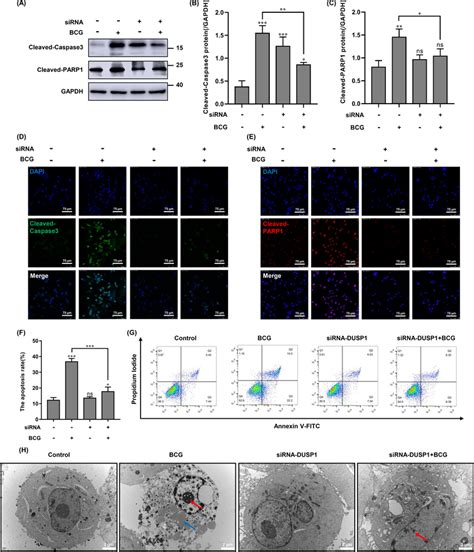 Effect Of Knockdown Of DUSP1 On BCG Induced Apoptosis In Macrophages