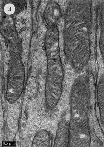 Giant Mitochondria In The Retina Cone Inner Segments Of Shrews Of Genus Sorex Insectivora