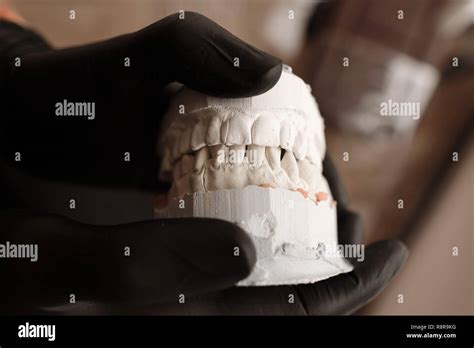 Plaster Cast Of Jaws Dentist In Black Gloves Holding Dental Casting