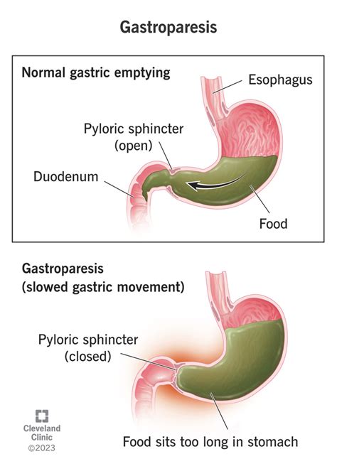 The Stomach Anatomy And 3d Illustrations 46 Off