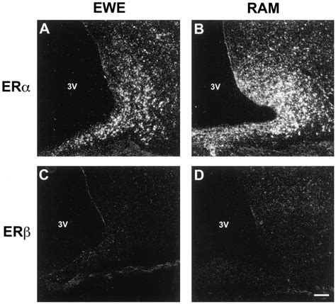 Low Power Darkfield Photomicrographs Of The Arcuate Nucleus In A Ewe A