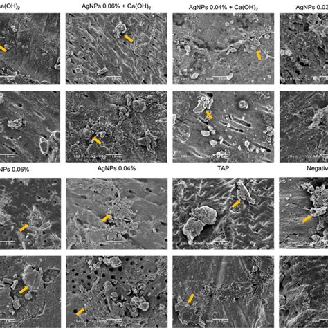 Representative Sem Images Of Human Mesenchymal Stem Cells Grown On