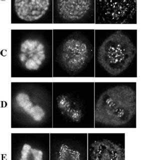 Localization Of Dna Topoisomerase Iia Phosphorylated At Threonine