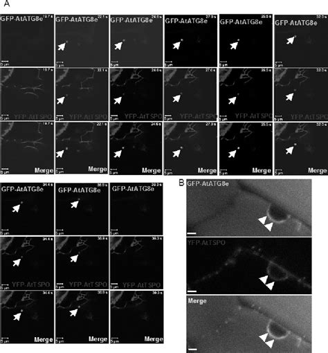 Figure From The Aba Regulated Arabidopsis Tspo Is An Er Golgi