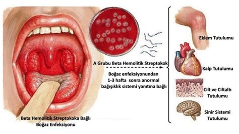 Çocuk Kardiyolojisi Nedir Doğumsal Kalp Hastalıkları Belirtisi Nelerdir