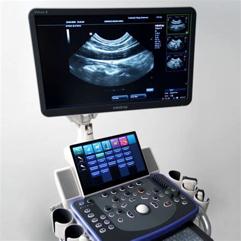 Mindray Vetus 7 Ultrasound System Northern Diagnostics