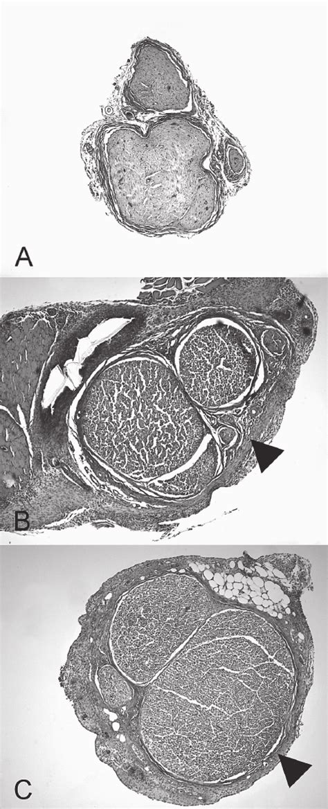 Representative Photomicrographs Of Thicker Sections 5 M M Wide Of