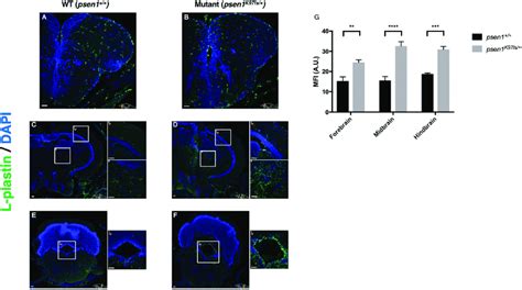 Cells Expressing L Plastin Are More Abundant Across The Heterozygous