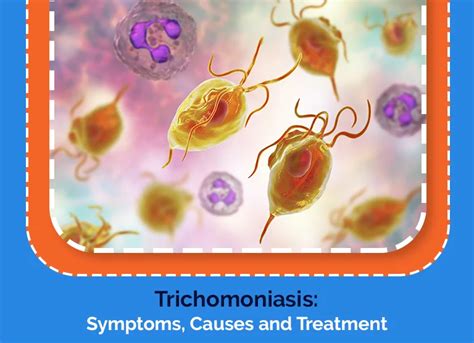 Trichomoniasis: Symptoms, Causes and Treatment | A Complete Guide