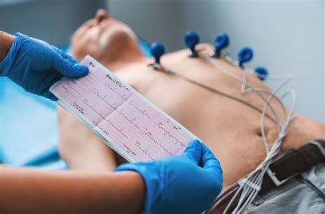 Electrocardiograma Qué es y cómo se mide Genea