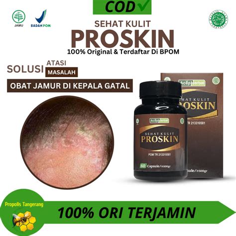 Jual Sehat Kulit Proskin Kapsul Asli Original Obat Gatal Di