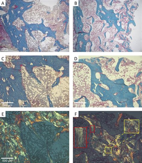 Optical Images From Bone Sections Stained With Goldner Trichrome From