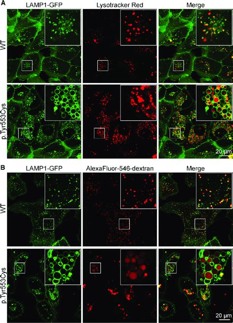 Vacuoles Formed By ClC 6 Tyr553Cys Show Variable Acidification And