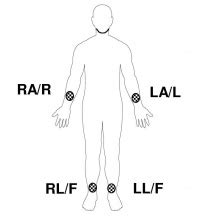 Cardiac Monitor - Protocopedia