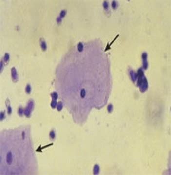 Clin Path Lecture Microscopic Urinalysis Pictures Flashcards Quizlet