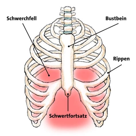 Bws Syndrom Ursachen Symptome Und Behandlung Flexmate