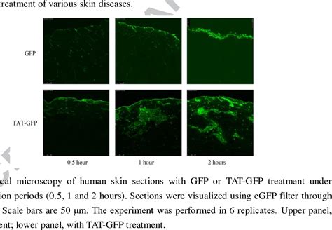 Pdf Topical Application Of Superoxide Dismutase Mediated By Hiv Tat