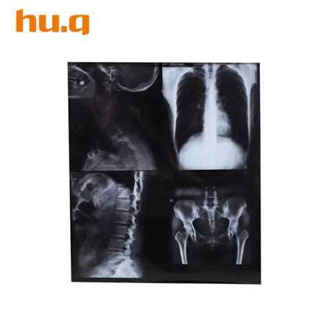 China Hq Kx Medical Dry Film Manufacturers And Suppliers Huqiu Imaging