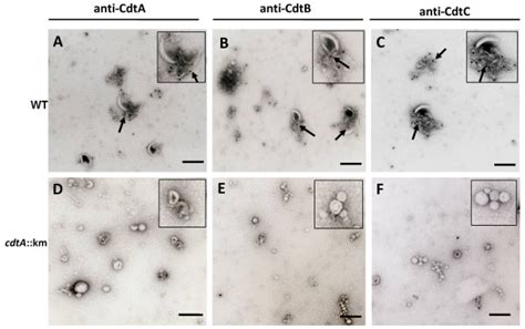 Electron Microscopy And Immunogold Labelling Of Cdt Immunoelectron