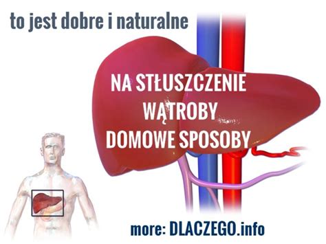 St Uszczenie W Troby Leczenie Naturalne Czyli Co Pomaga Na W Trob