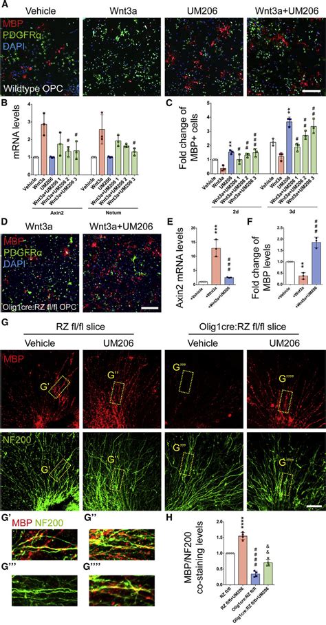 Fzd Inhibition Via Um Promotes Opc Differentiation And Ex Vivo