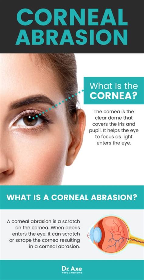 Corneal Abrasion Natural Ways To Relieve A Scratched Eye Dr Axe