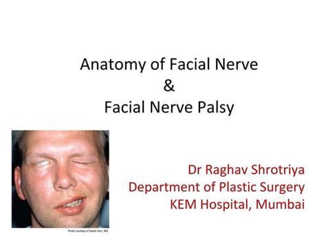 Paralysis of facial nerve | PPT