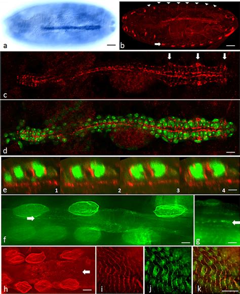 Cap Is Expressed In The Drosophila Heart Throughout Development A
