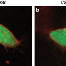 Intracellular Expression Of Green Fluorescent Protein Zsgreen Fused