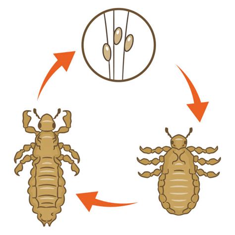 80 Head Lice Stock Illustrations Royalty Free Vector Graphics And Clip