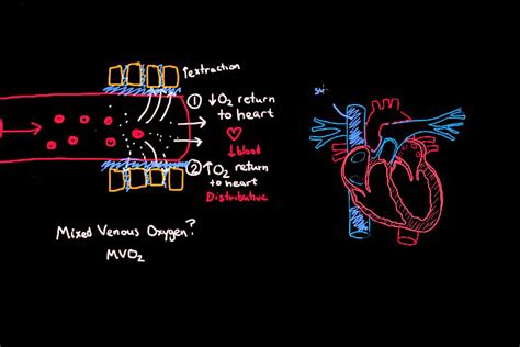 Pathophysiology Of Shock